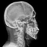 Advances in Biomarkers, Biomaterials, Inflammatory and Immune Microenvironment, and Therapeutic Strategies for Head and Neck Cancer