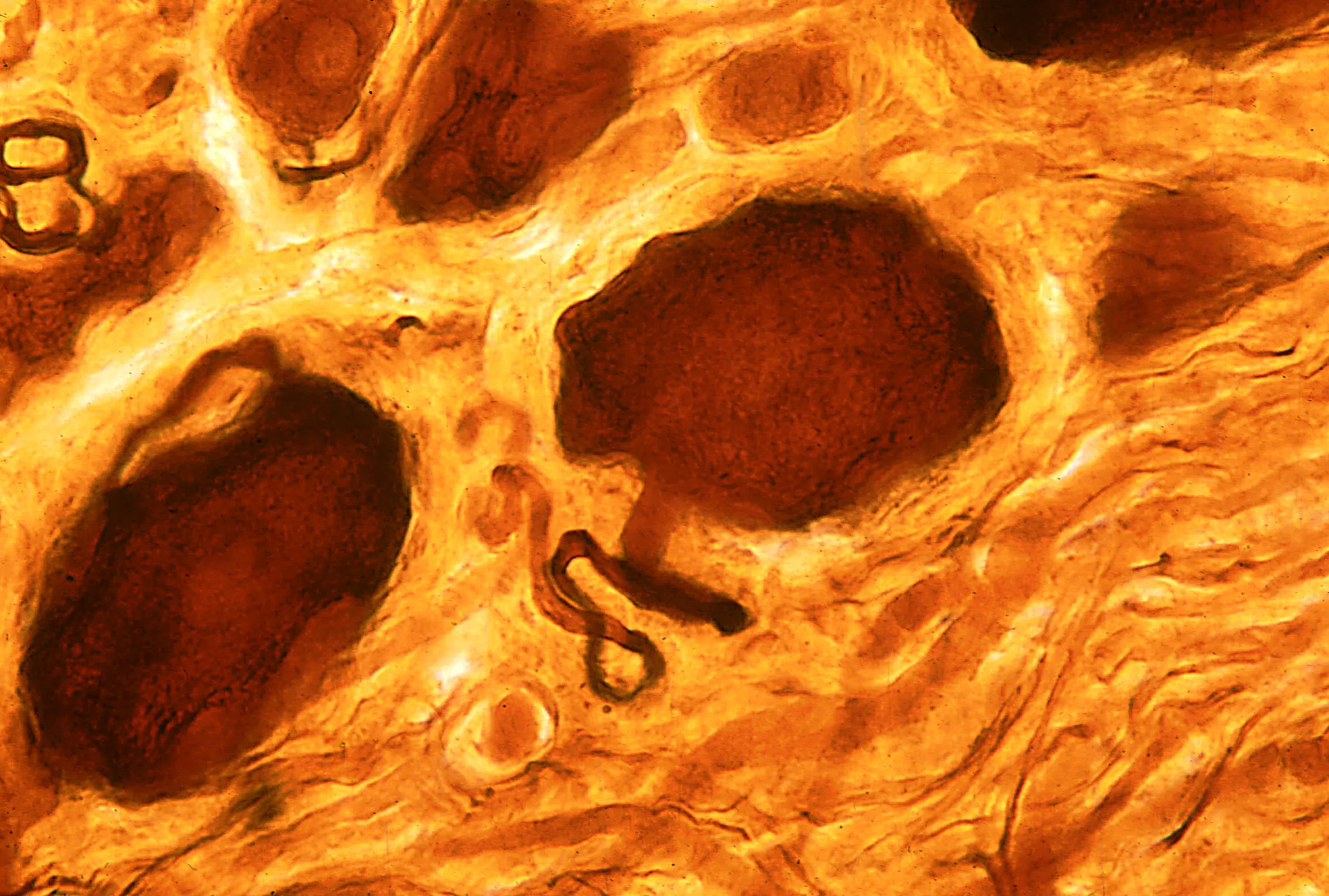 Decoding tRNA dynamics in neuroimmune disorders: From mechanistic insights to innovative therapies