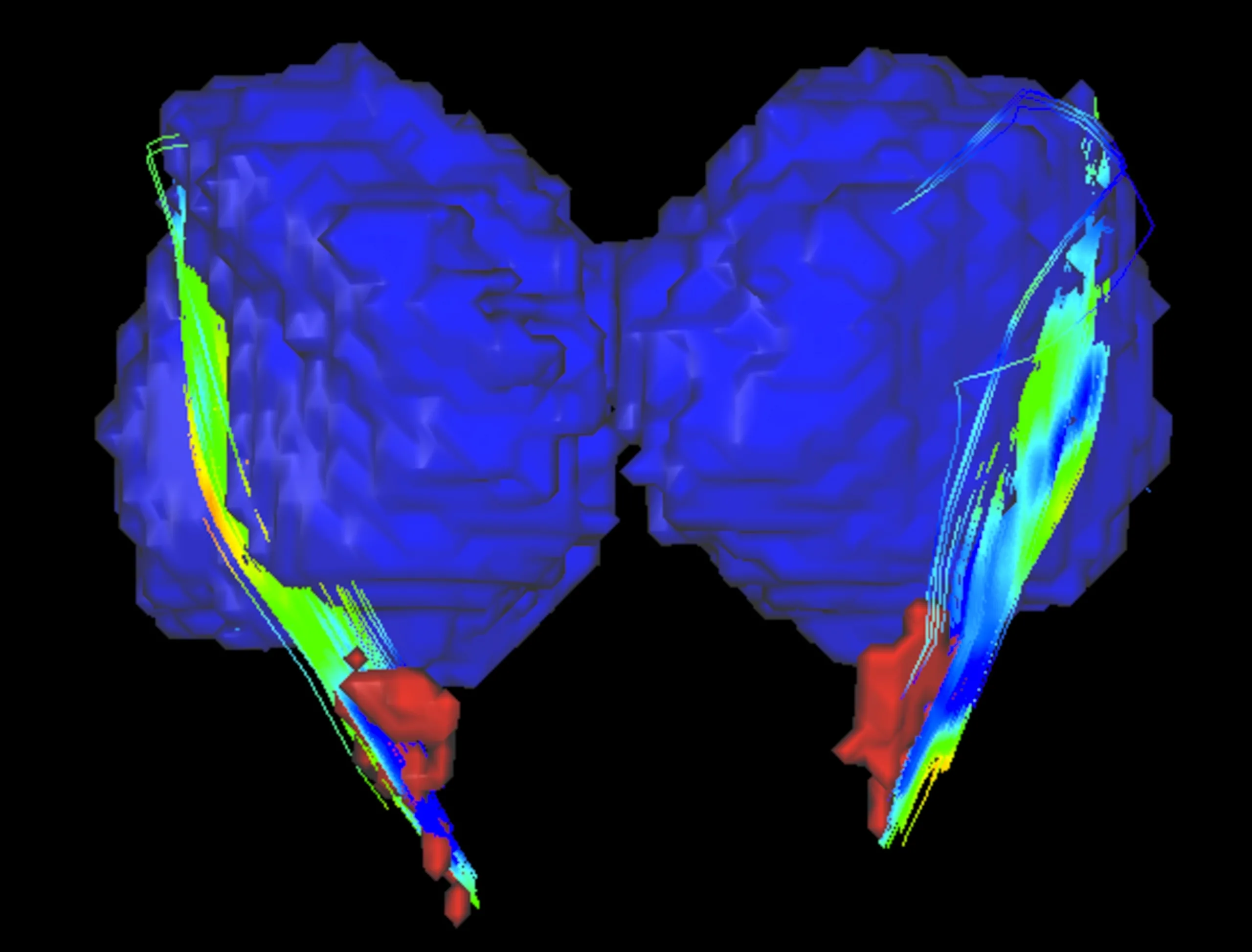 AI for Computational Neuroscience: Methods, Applications, and Trustworthiness