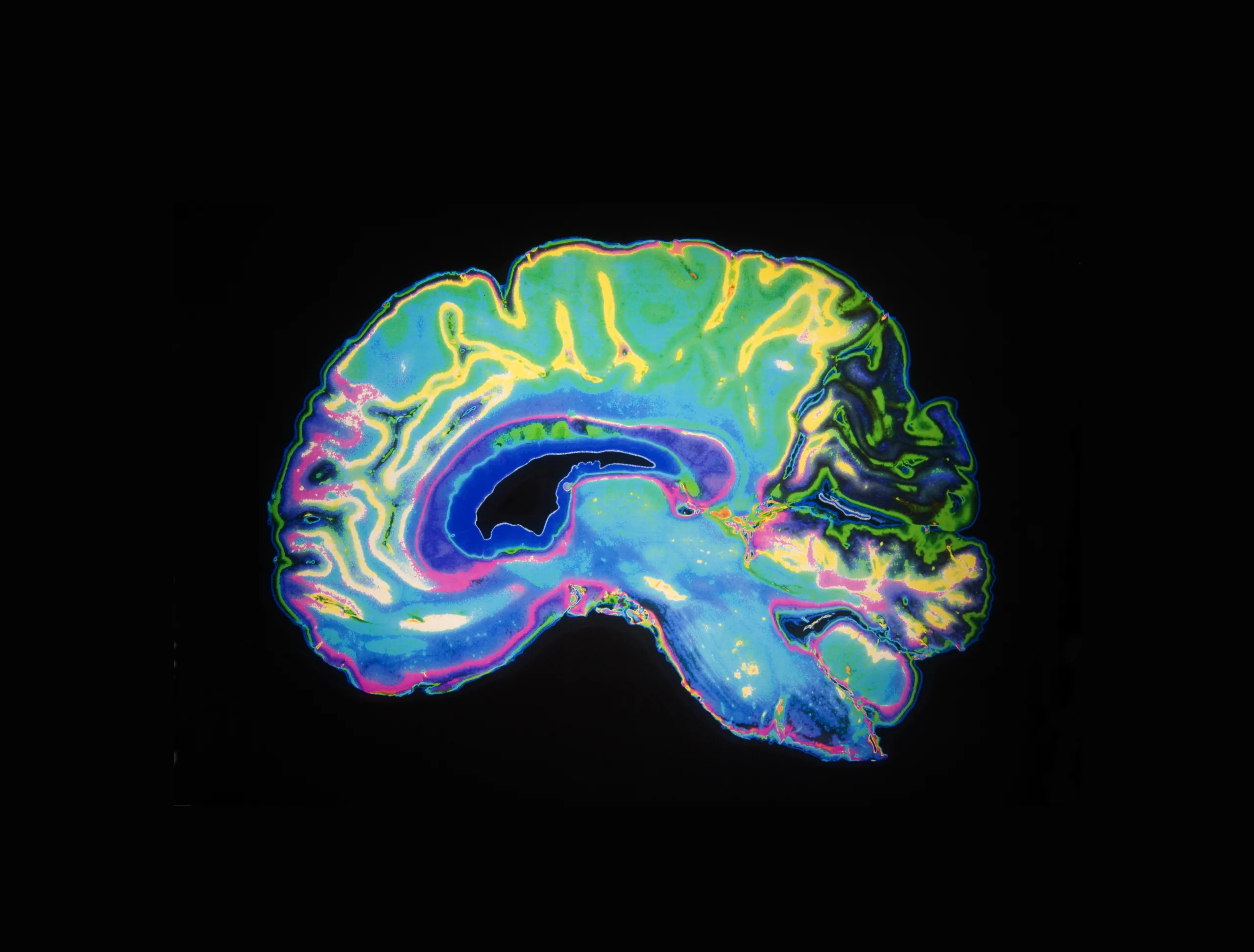 Frontiers in Behavioral Neuroscience