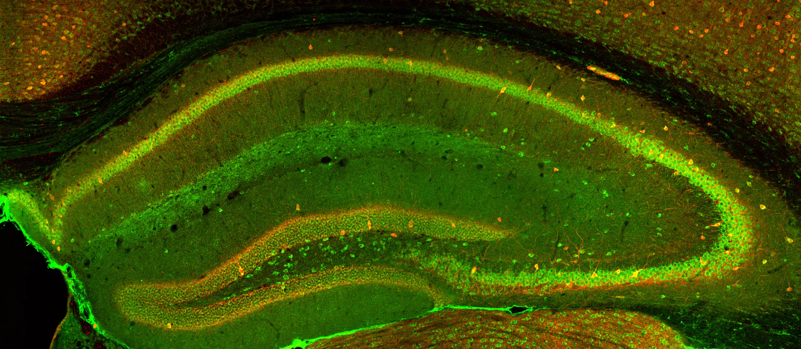 Frontiers in Cellular Neuroscience