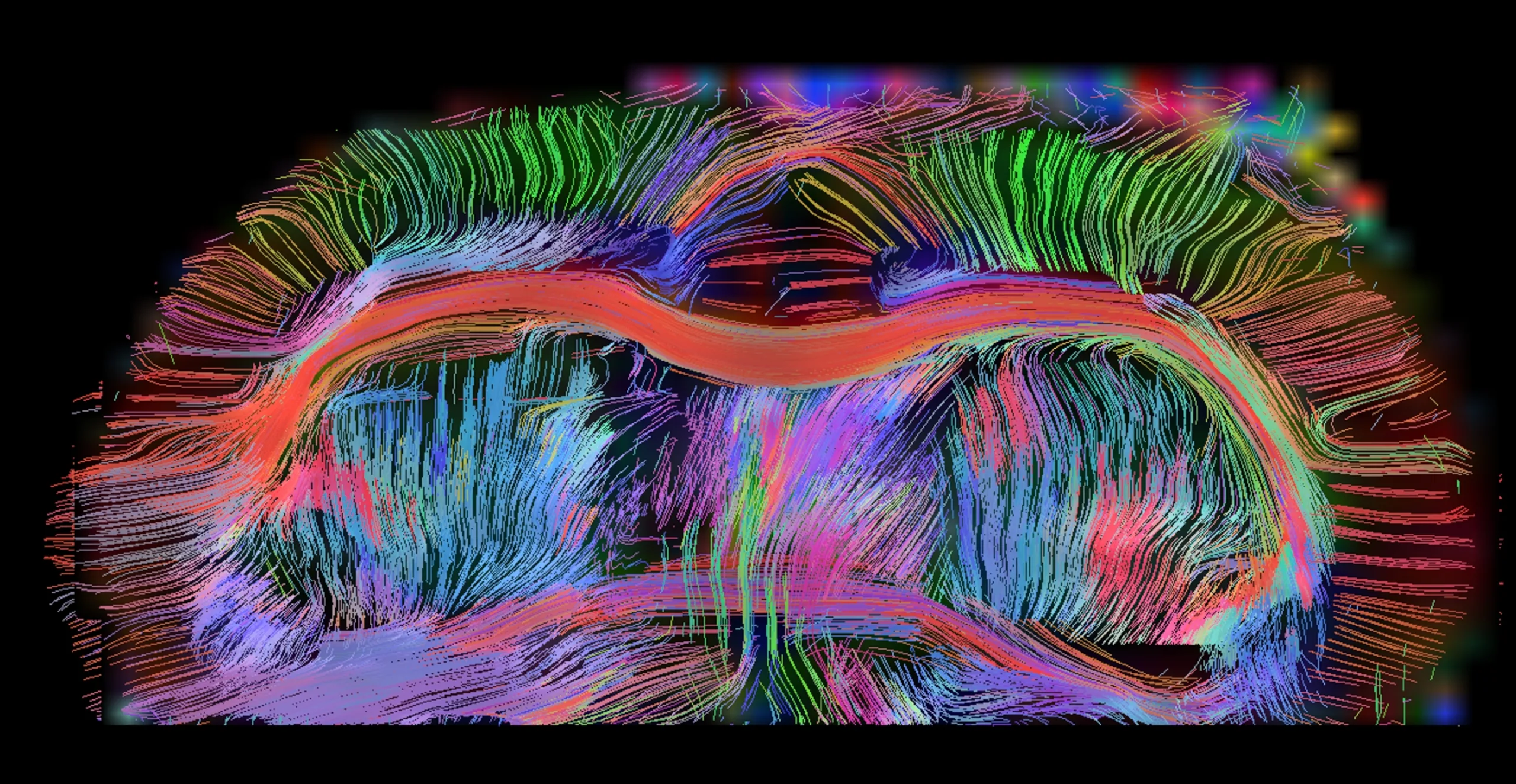 Frontiers in Neuroimaging