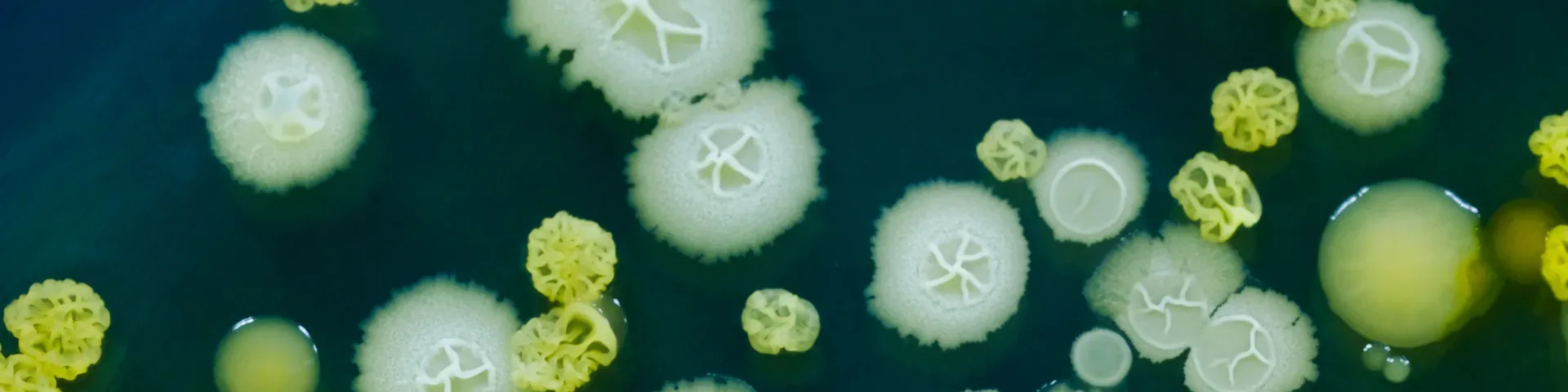 Frontiers in Cellular and Infection Microbiology