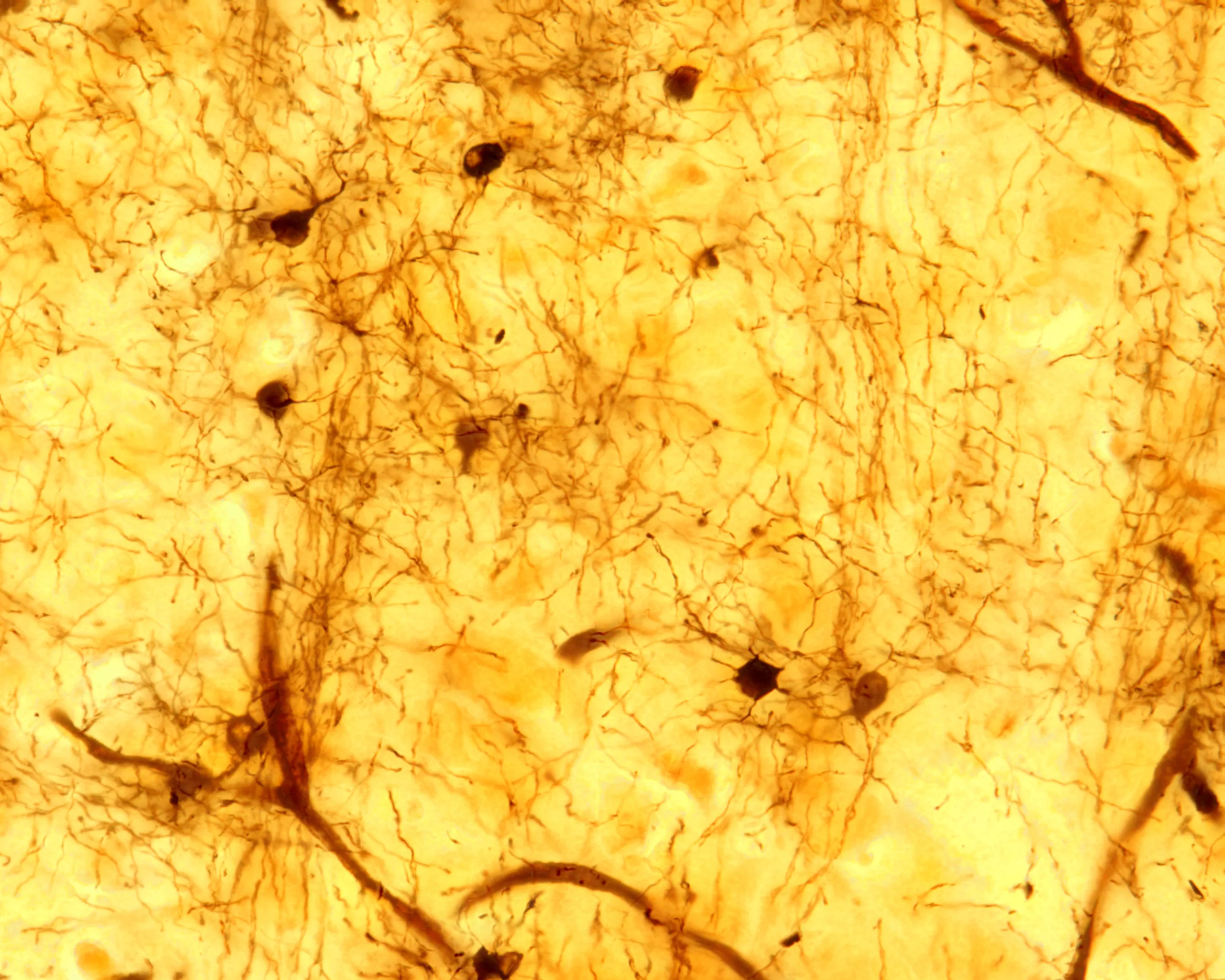 Alpha-Synuclein dynamics in Cellular and Molecular Mechanisms of Brain-aging