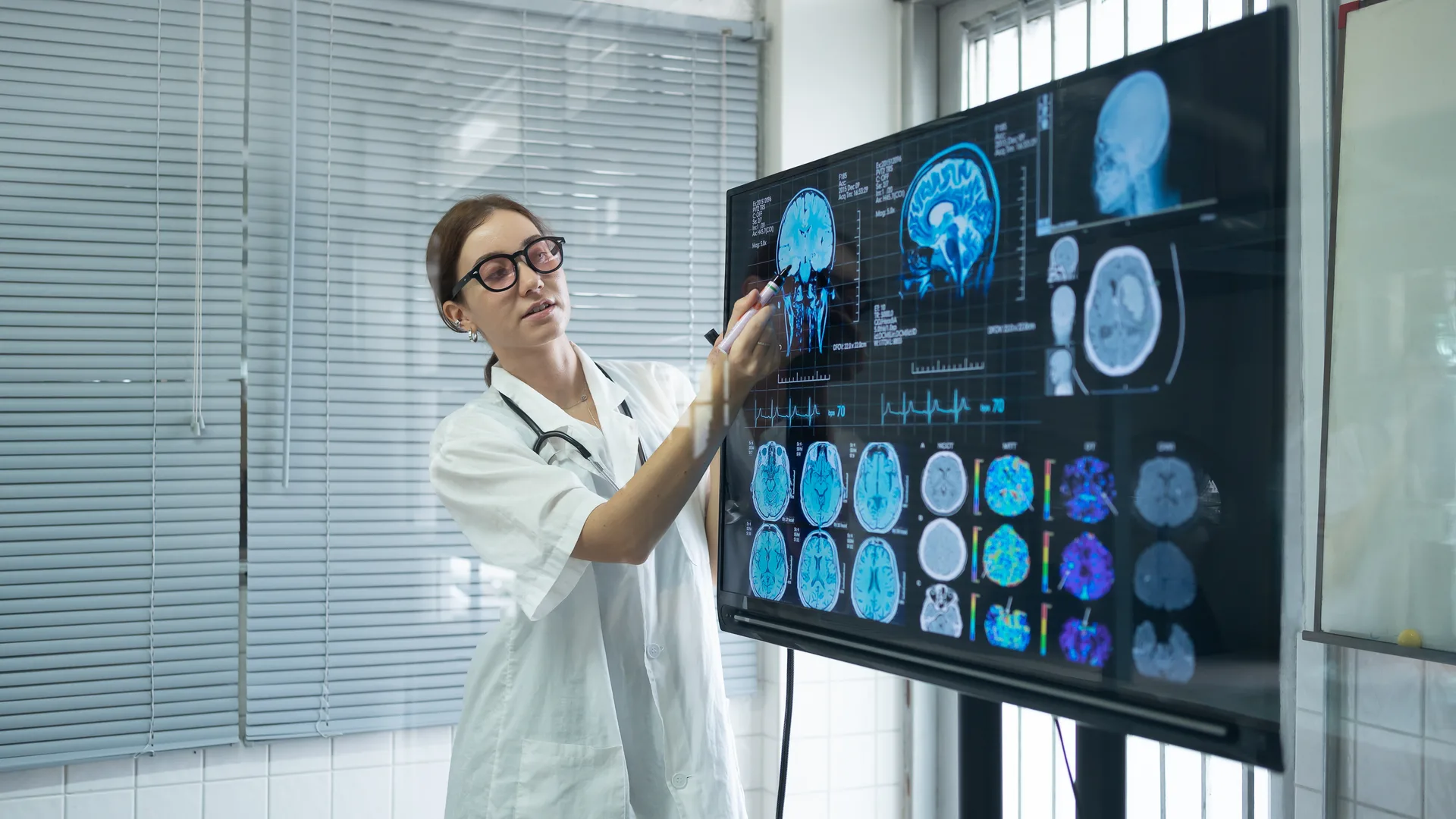 Artificial General Intelligence Empowers Brain Imaging Analysis: from Diagnosis to Pathogenesis