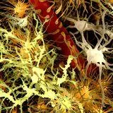 Fluid Biomarkers in Neurodegeneration: Revolutionizing Early Detection and Prognosis