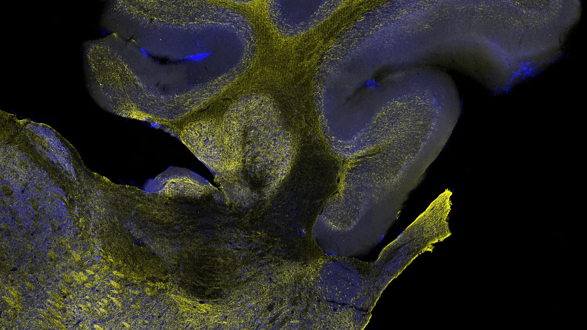 Fresh Perspectives on Comparative Neuroanatomy: How the Nervous Systems of Animals Inform Us About the Human Nervous System