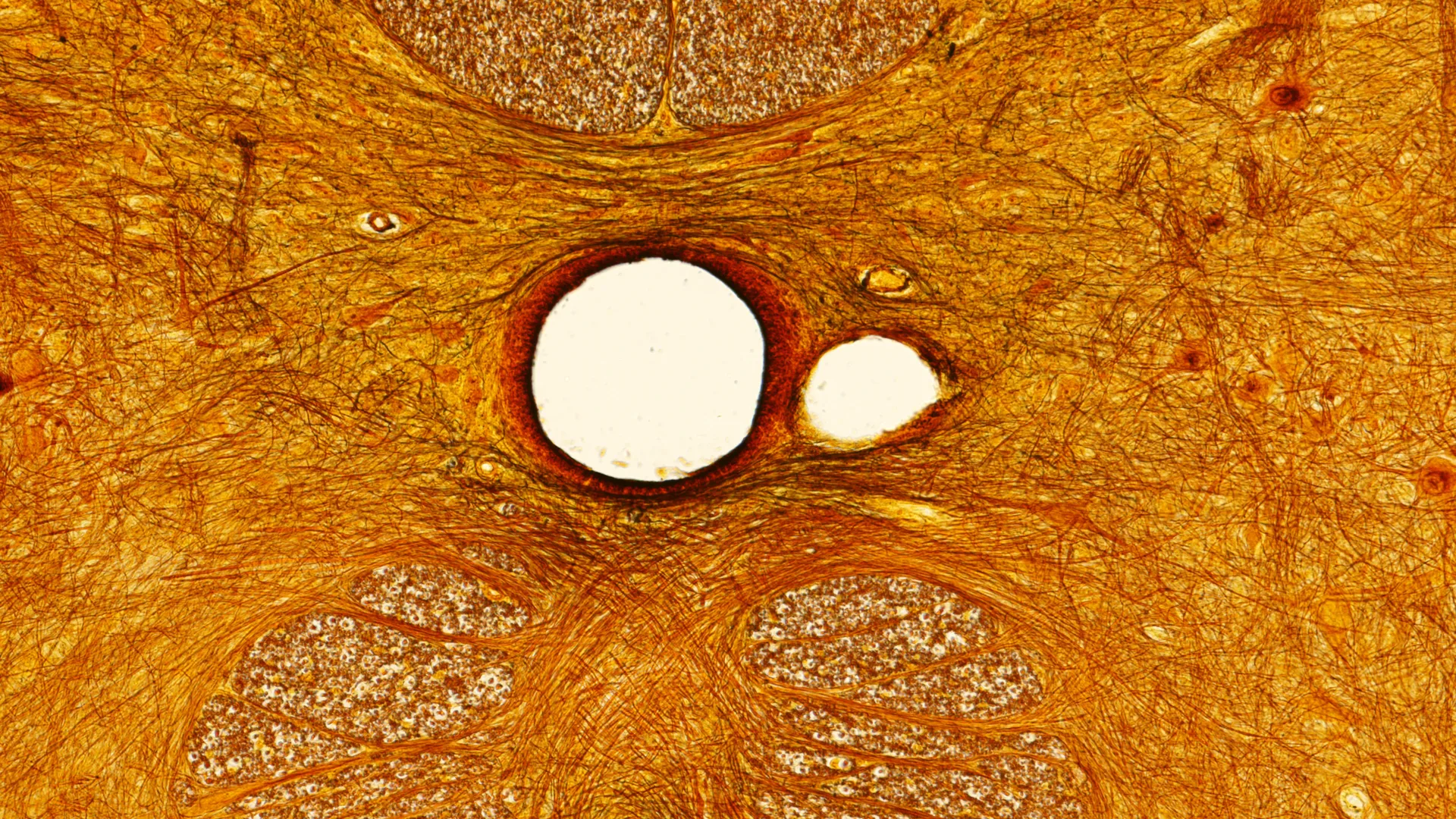 Structural Organization of Spinal Cord Circuits in Health and Disease