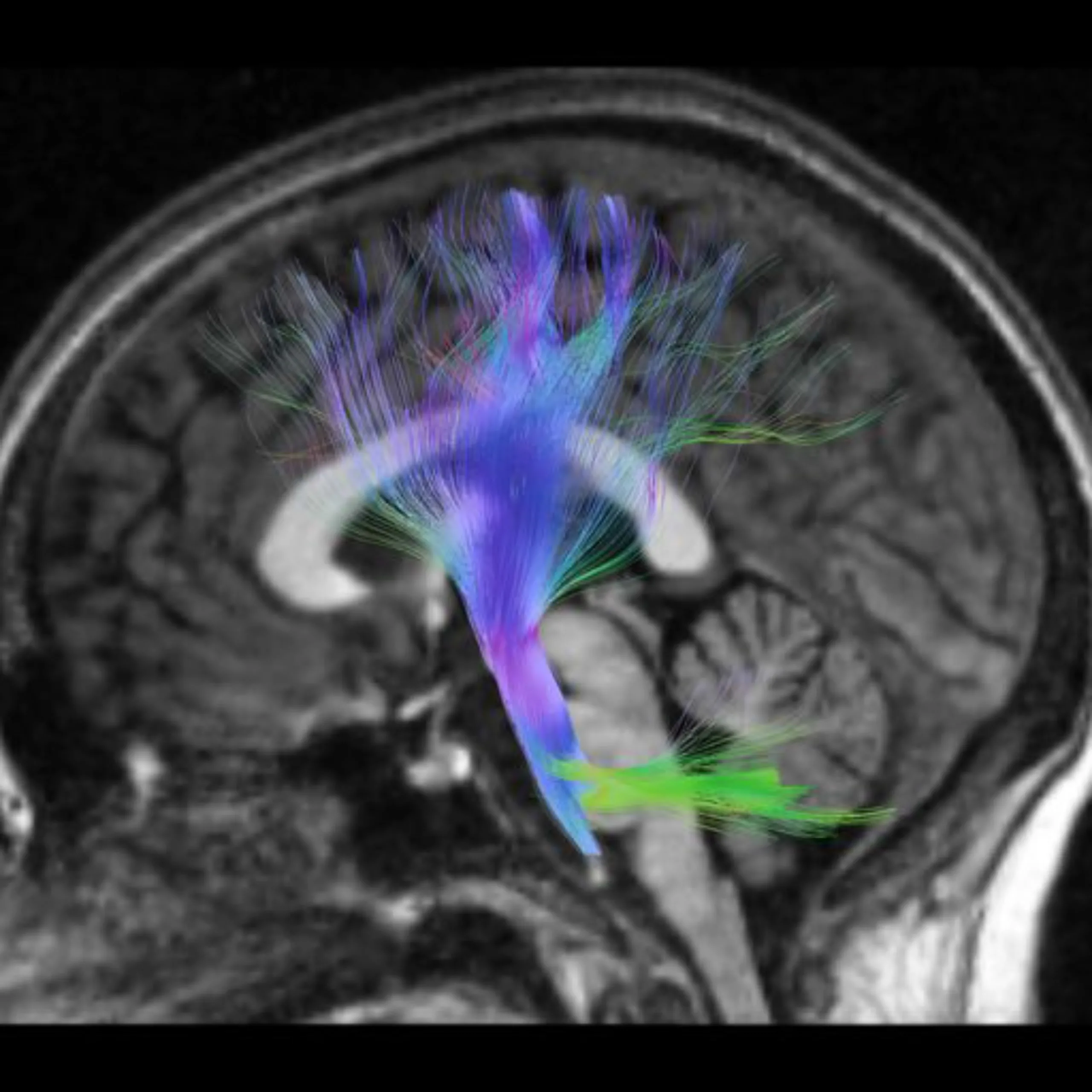 Women in Integrative Neuroscience: Advances, Innovations, and Challenges from the Female Perspective