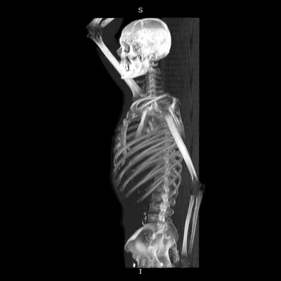 Application of Deep Learning in Biomedical Image Processing, Volume II