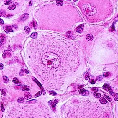 Trophic, Metabolic and Immune Checkpoints of Remyelination Failure in CNS Disease