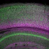 Biomarker Discovery and Validation in Neurological Diseases, volume II