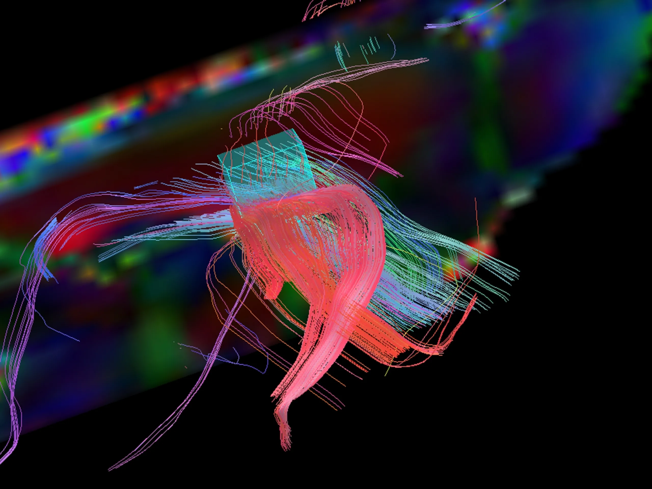 Computational models of neuromodulation