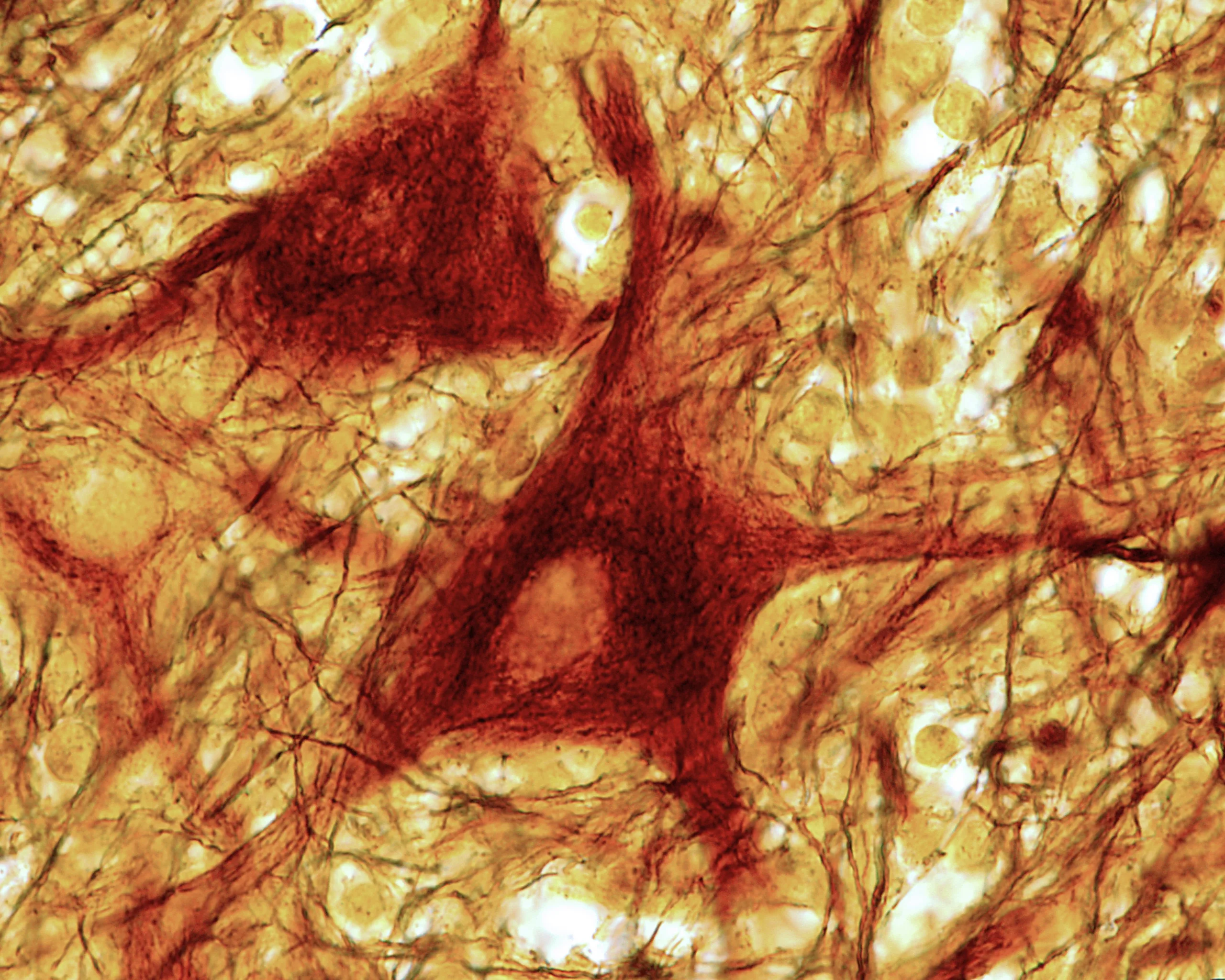 Neuromorphic and deep learning paradigms for neural data interpretation and computational neuroscience - Volume II