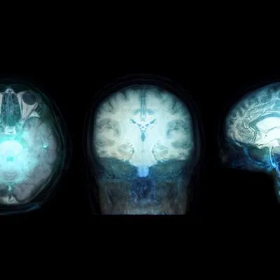 Advanced Molecular and Imaging Biomarkers for Neurological Disorders