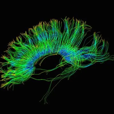 Neuroimaging-Informed Neuromodulation: Targeting, Personalization and Validation