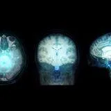 Biomarkers and Radiomic Features in Medical Imaging of Head and Neck Diseases