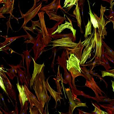 Cellular mechanisms and therapeutic targets in fibroblast-mediated lung immune disorders