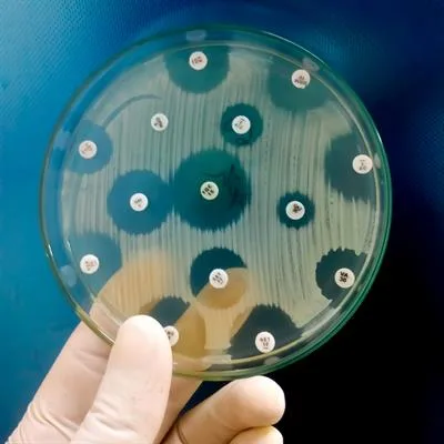 Managing Infections in Orthopedic Surgery: From Surgical Strategy to Innovative Antimicrobial Therapeutics