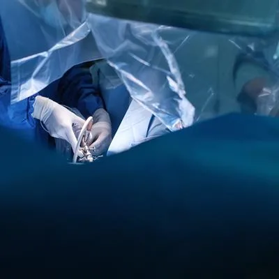 Advances in Minimally Invasive Colorectal Surgery: Laparoscopy, Robotic and NOSE Approach